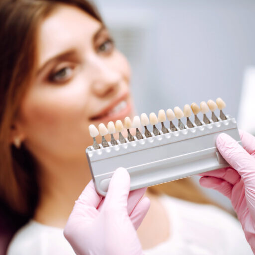 Beautiful woman smile with healthy teeth whitening. Matching shades of the implants. Healthy Smile.
