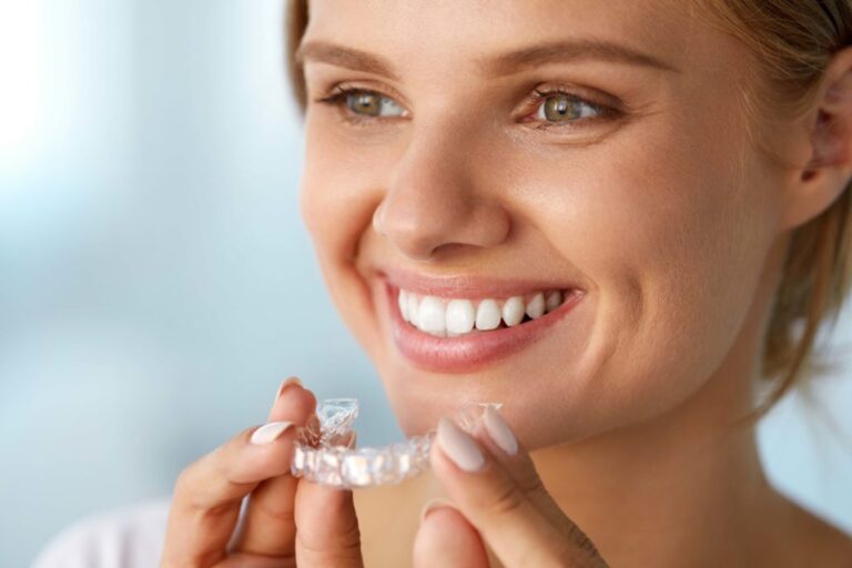 Invisalign Large Invisalign Large